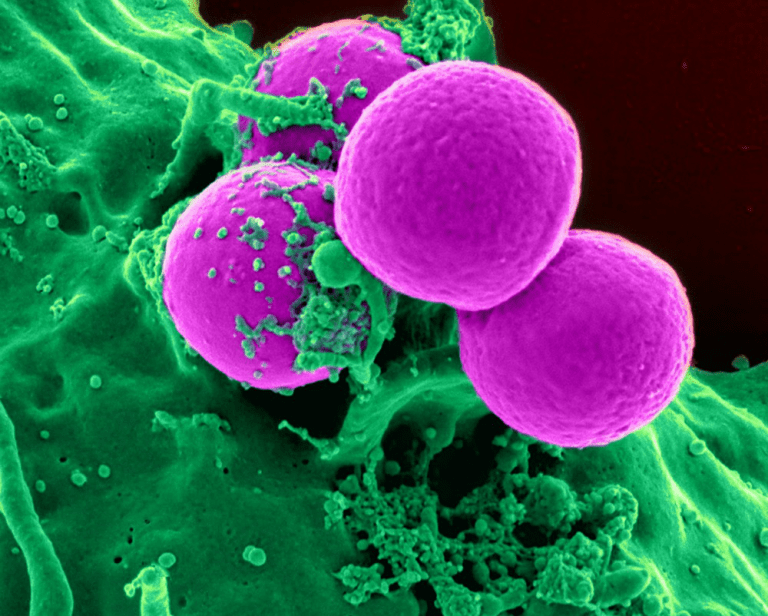immunotherapy, for Manhattan Beach patients, is a newer form of skin cancer treatment which enhances our immune system's ability to kill cancer cells.