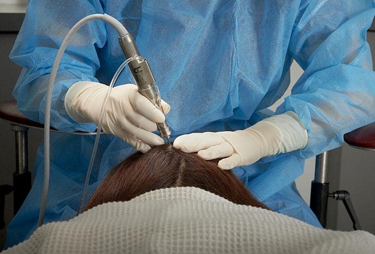 Dr.UGraft™ is the first-ever all-in-one system able to extract hair of all textures from all parts of the body. This includes the nape area, chest area, scalp area, and pubic area.