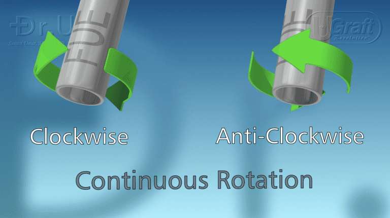 Rotary FUE punches can turn either clockwise or counter-clockwise. Rotary FUE punches can turn either clockwise or counter-clockwise.