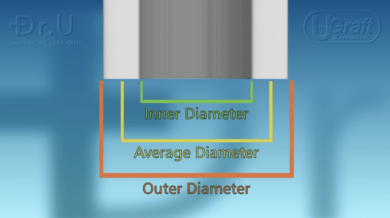 The inner diameter, the average diameter, and the outer diameter of the FUE punch tip all influence the performance of the FUE punch.