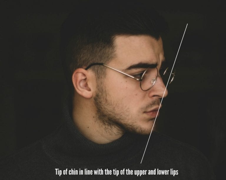 Surgical and non-surgical chin augmentation aims for more classic lower facial proportions Surgical and non-surgical chin augmentation aims for more classic lower facial proportions.