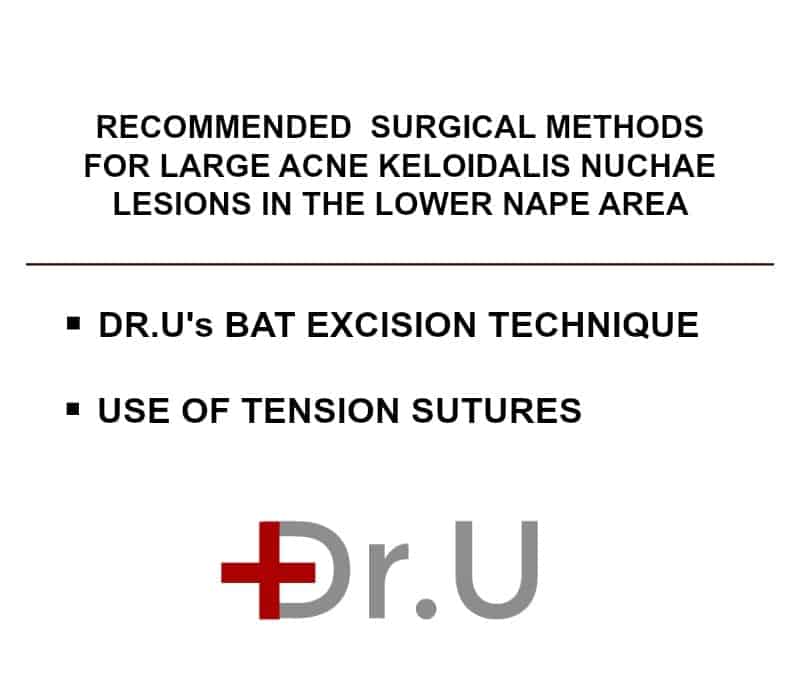 The use of Dr.U's bat excision technique helps to ensure a straight linear scar aligned with the posterior hairline. Tension sutures allow the surgeon to exert control over the wound closure process