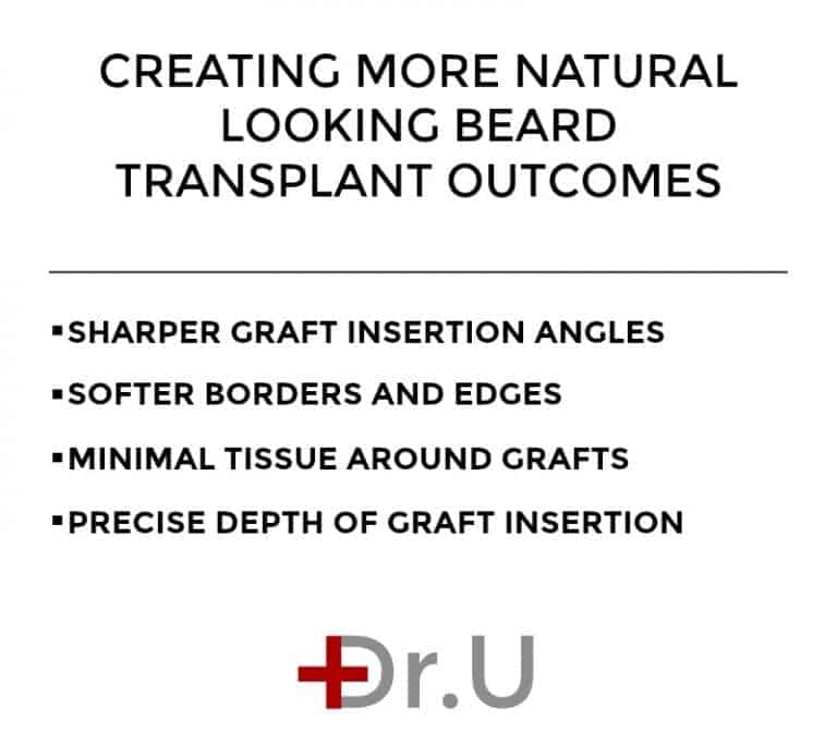 Dr.U's surgical considerations for creating more natural looking beard transplant results