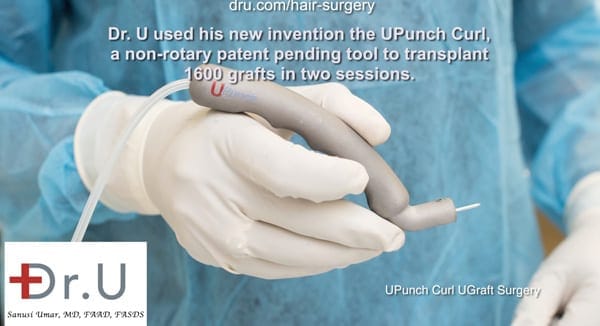 The innovation of the DrUPunch Curl was a breakthrough in FUE hair restoration for black African men
