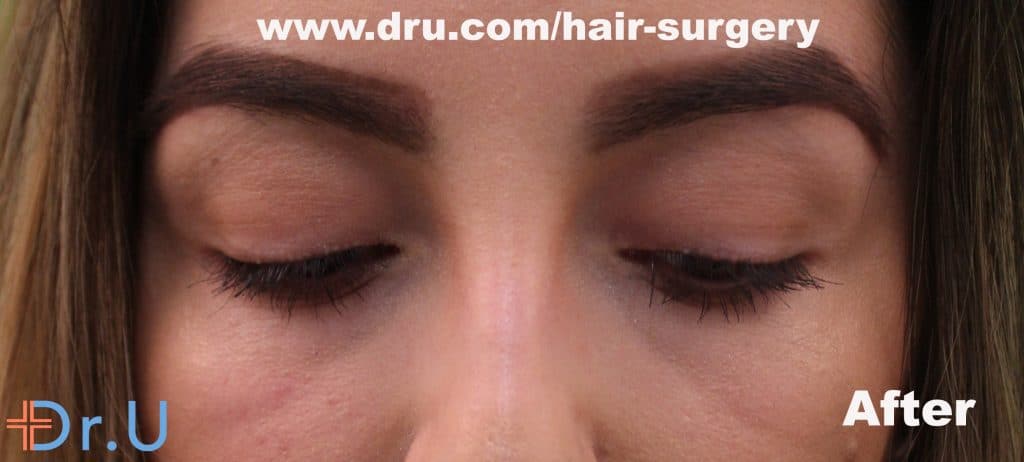 Michelle's VeeLashe Results