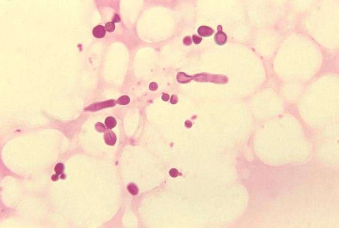 Malassezia Yeast