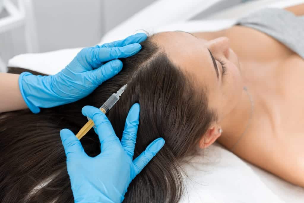 Stromal Vascular Fraction SVF is delivered to target areas like the scalp by direct injections