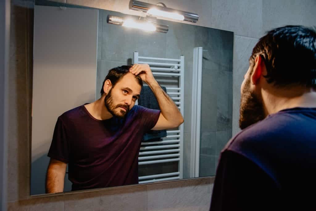 Hair loss can cause insecurities