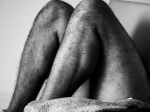 Surgery to restore chest hair can often necessitate the need to have matching and comparable amounts of leg hair as well. 