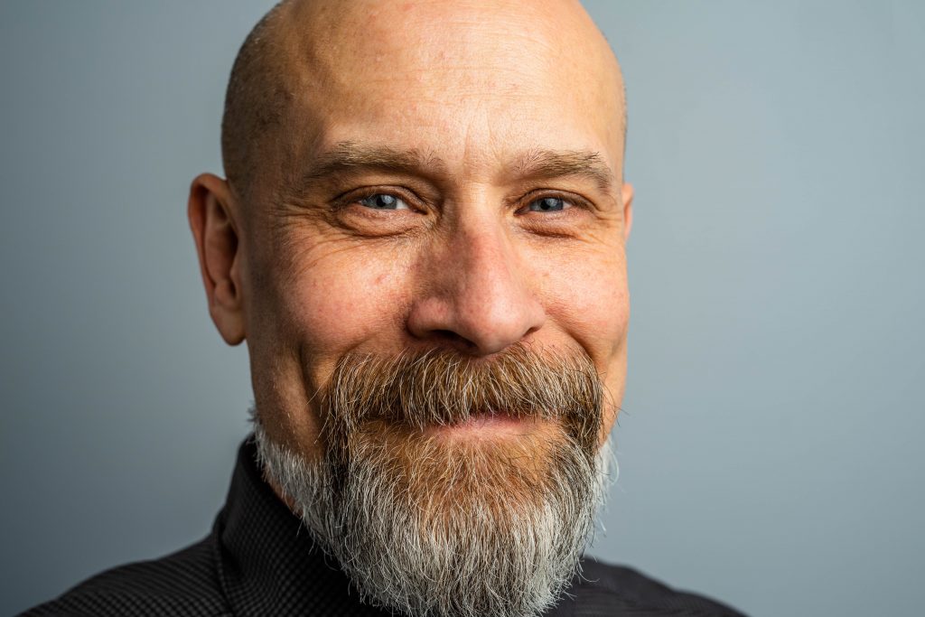 severe baldness and society