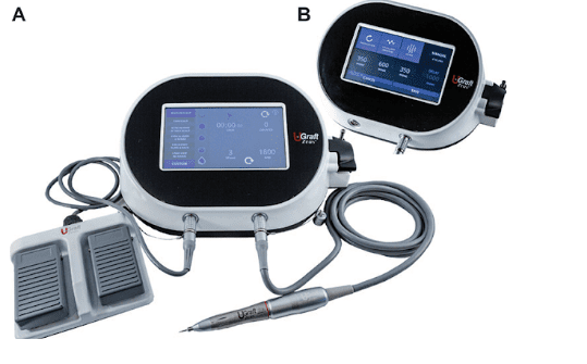 Figure 1 The all-purpose FUE device: (A) Main Panel: The system, consisting of the console, handpiece, foot pedal, and optional fluid integration. The dashboard shows six presets, custom mode, torque control, speed, timers, and reset features; (B) inset: The dashboard displays three movement modes, adjustable movement duration, score intervals, and automatic/manual modes. Figure 1 The all-purpose FUE device: (A) Main Panel: The system, consisting of the console, handpiece, foot pedal, and optional fluid integration. The dashboard shows six presets, custom mode, torque control, speed, timers, and reset features; (B) inset: The dashboard displays three movement modes, adjustable movement duration, score intervals, and automatic/manual modes.
