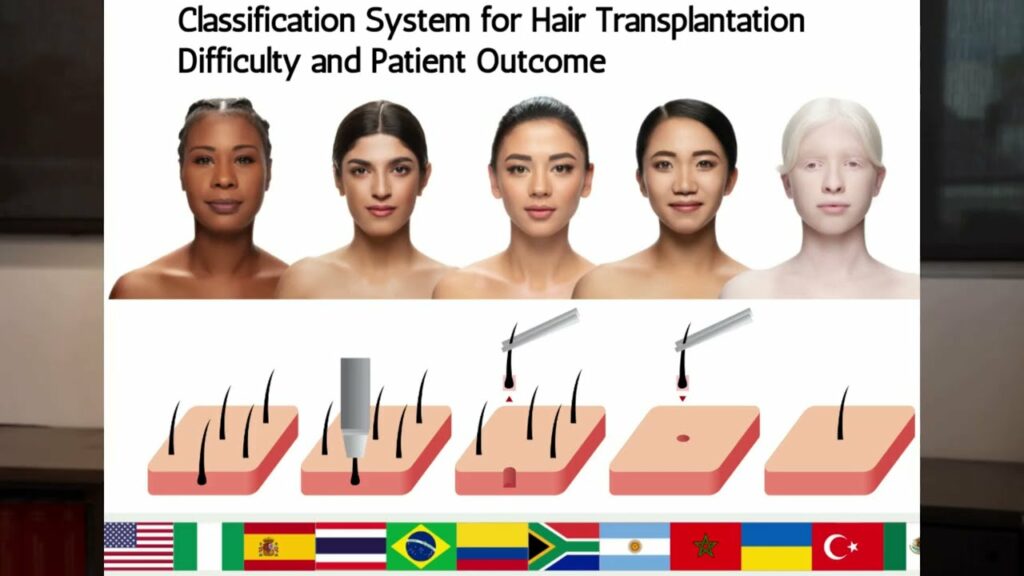 A New Follicular Unit Extraction - FUE Classification System For Hair Transplant Patients