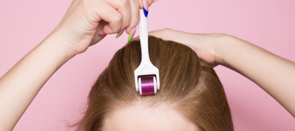 A less widespread use of microneedling is as hair loss treatment. A less widespread use of microneedling is as hair loss treatment.
