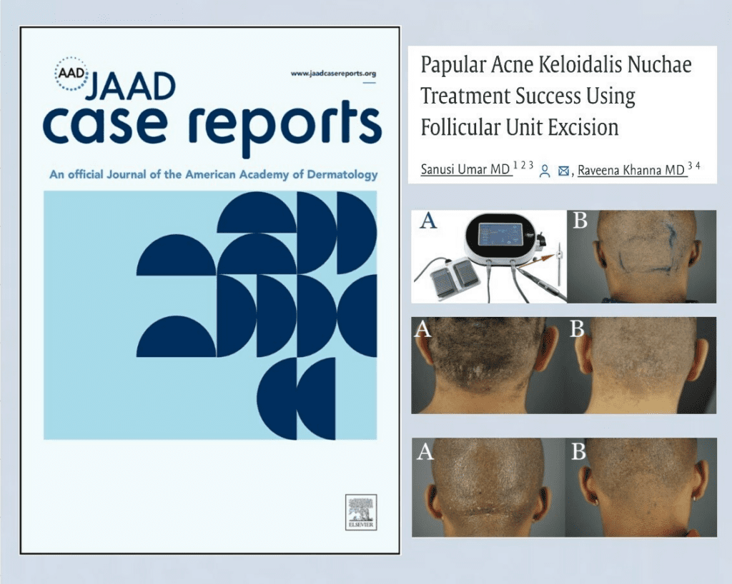 The groundbreaking study was published in the JAAD Case Reports journal.