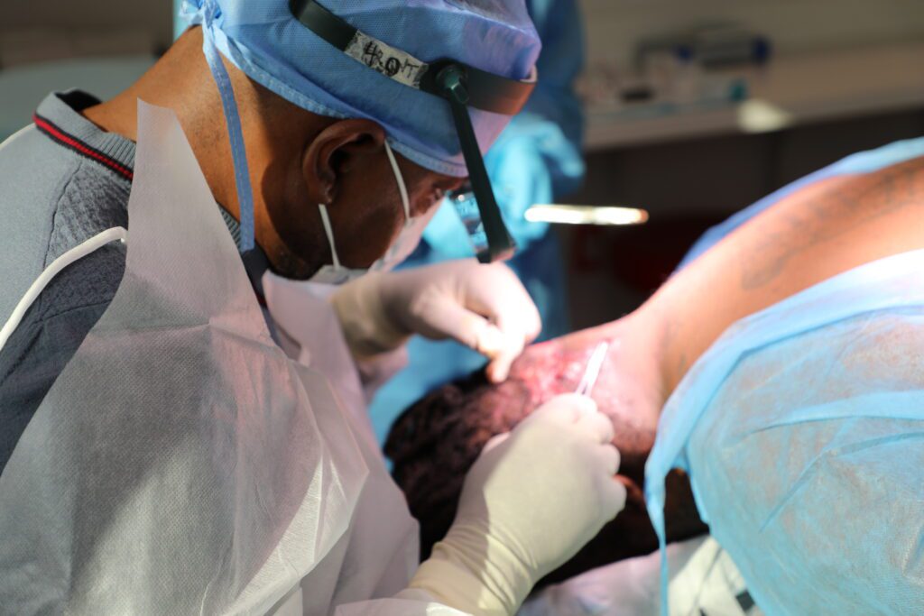 Dr. Sanusi Umar performing surgical excision on a large Acne Keloidalis Nuchae (AKN) lesion at the back of a patient’s head