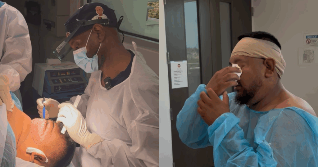 Dr. Umar performing surgical excision of AKN mass to remove disfiguring scalp lesion and restore patient’s confidence.