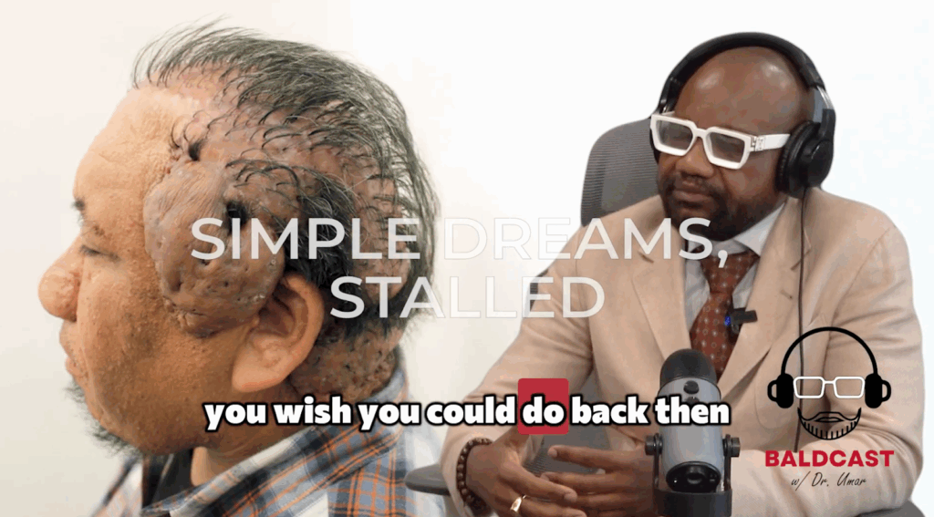 Dr. Sanusi Umar asks Robert about his dreams and aspirations while living a life with severe hairline bumps.
