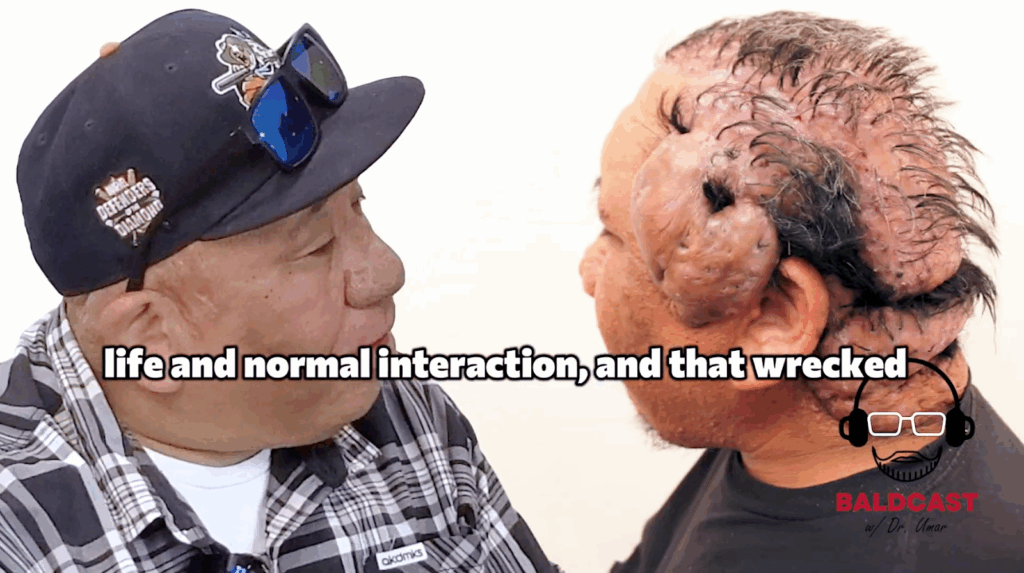 Like most men, Robert longs to have a normal life such as getting married and having kids. But due to his condition, social interaction is a very difficult thing to accomplish.