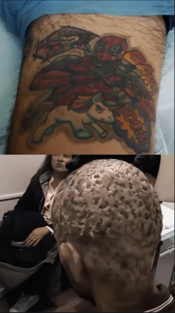 Deadpool tattoo on a leg above a rear view of Kevin’s scalp.