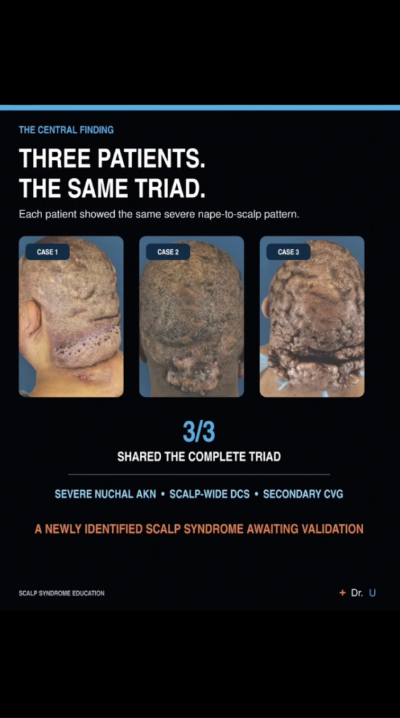 Graphic showing three scalp case photographs labeled Case 1, Case 2 and Case 3 with text stating all three shared the same triad.