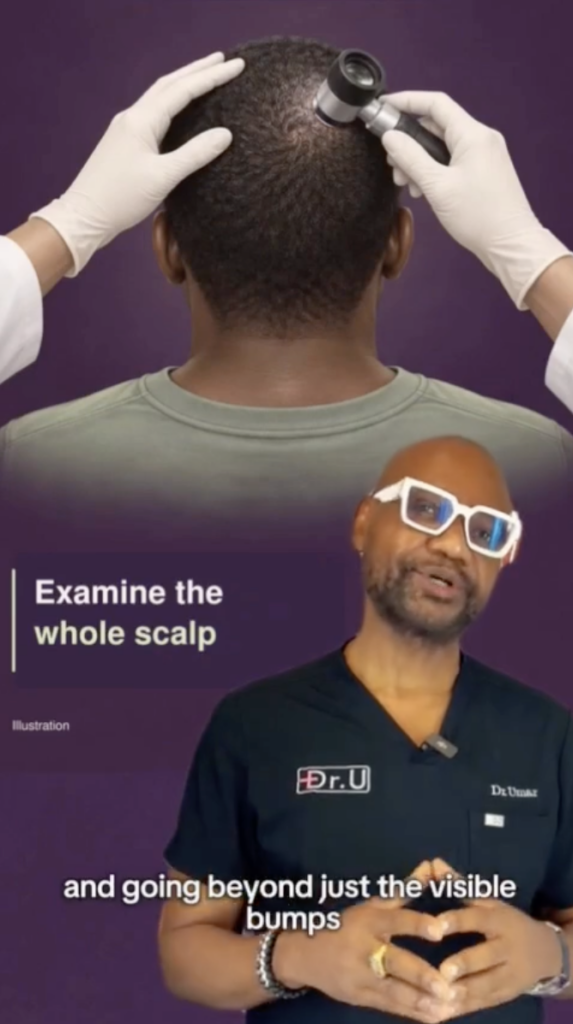 Clinician examining the back of a person’s scalp with a handheld magnifying instrument while Dr. Sanusi Umar appears below.
