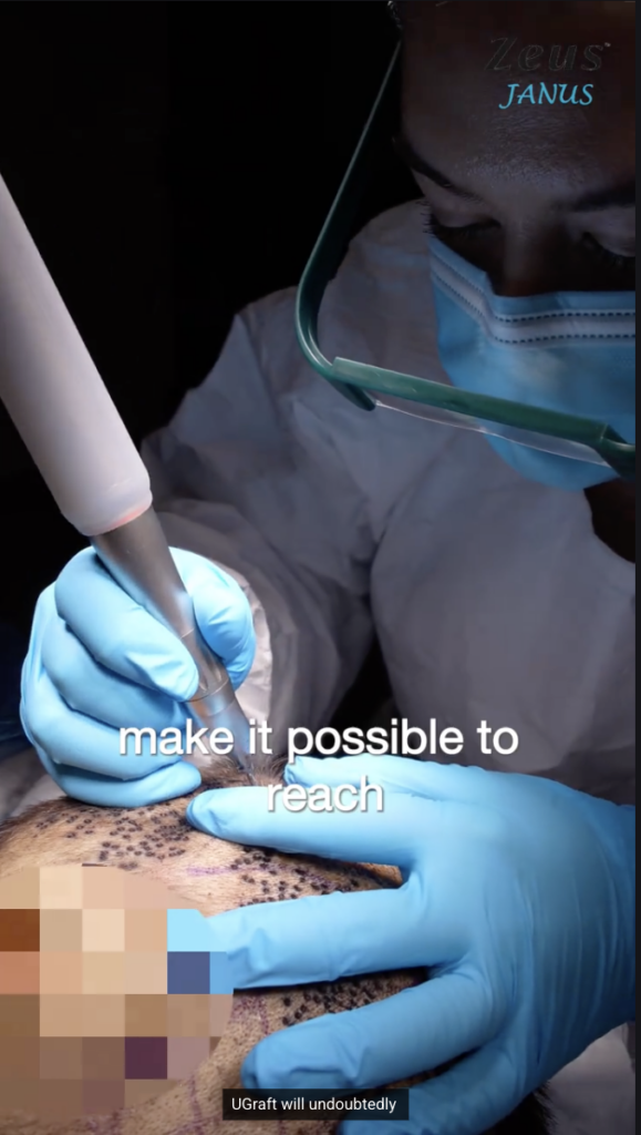 Gloved clinician using a handheld device on a scalp during a close-up training demonstration.