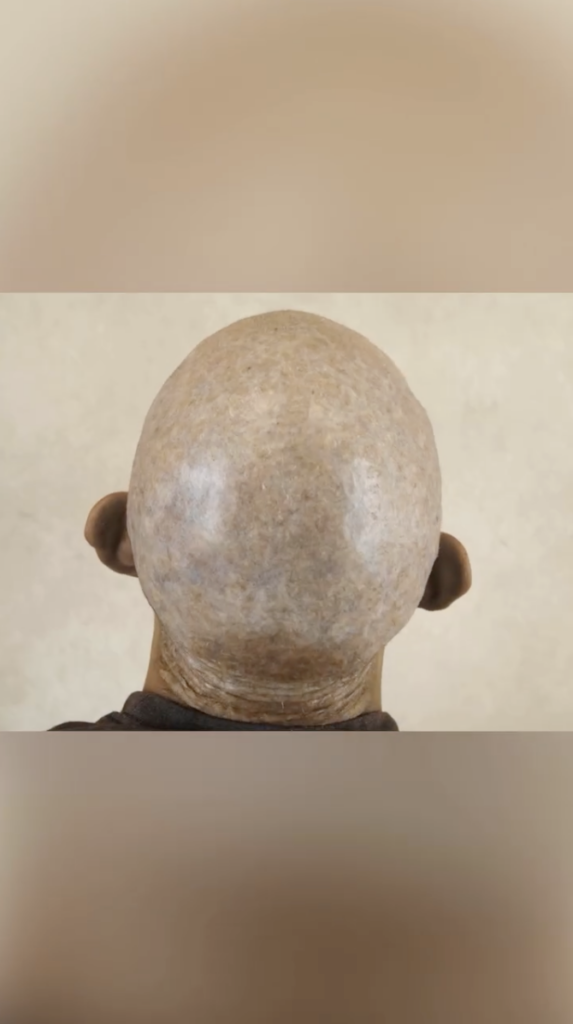 Rear view of a closely shaved scalp against a light-colored background.