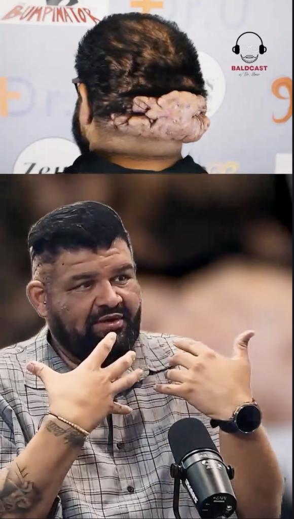 Composite video frame showing the back of a person’s head above a seated bearded man speaking into a microphone.