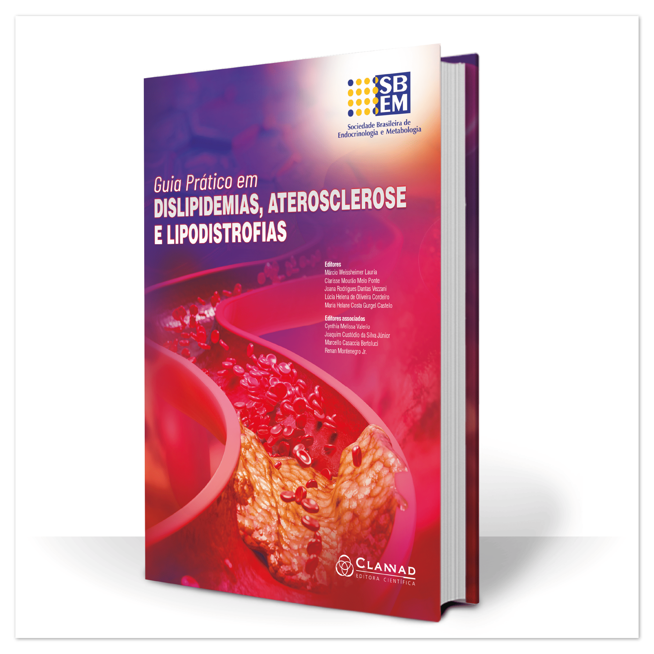 Guia Prático em Dislipidemias, Aterosclerose e Lipodistrofias