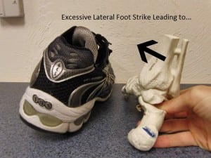 Supination - shoe a foot - rear view