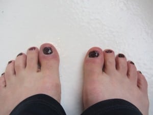 Pam Smith - three weeks post-toenail surgery - painted