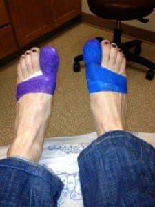 Pam Smith - post toenail surgery