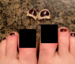 Pam Smith - Desert Solstice plus five days - big toenails gone - censored