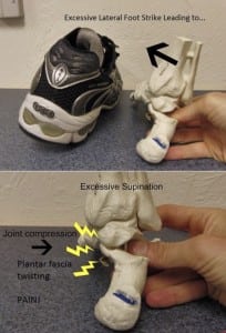 Excessive lateral footstrike diagram 600px