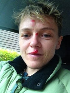 Jo Meek - Treadmill Fall