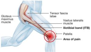 IT band anatomy