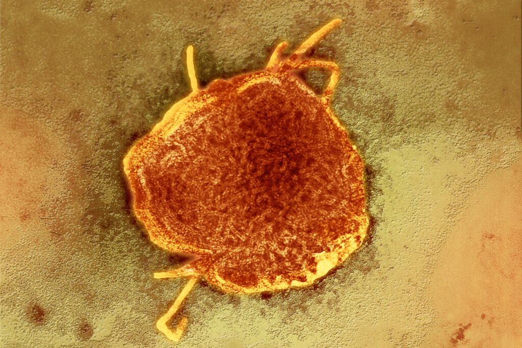 Teddy Rosenbluth Measels Outbreak In Texas - LetsRun.com