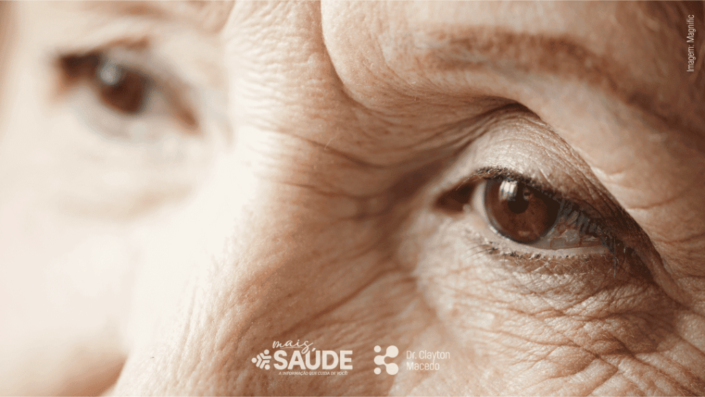 Mais-saude-Thumbs-Blefarite
