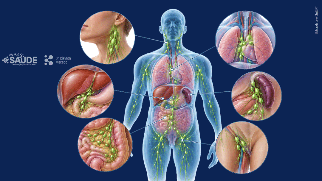 Mais-saude-Site-Thumbs-Linfoma-não-Hodgkin