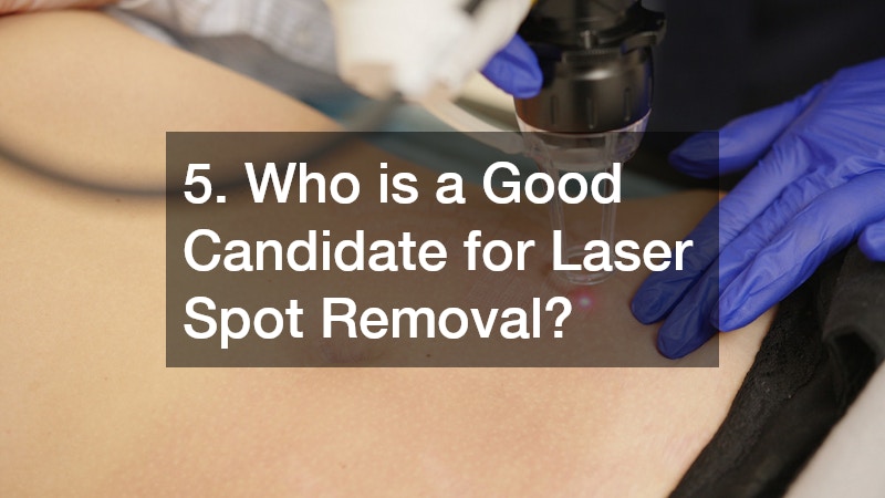 5. Who is a Good Candidate for Laser Spot Removal?