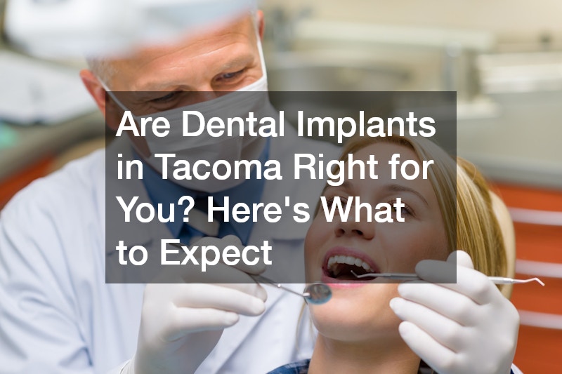 Are Dental Implants in Tacoma Right for You? Here’s What to Expect