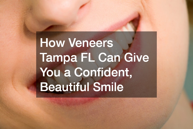 How Veneers Tampa FL Can Give You a Confident, Beautiful Smile