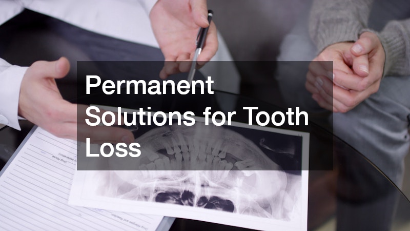 Permanent Solutions for Tooth Loss
