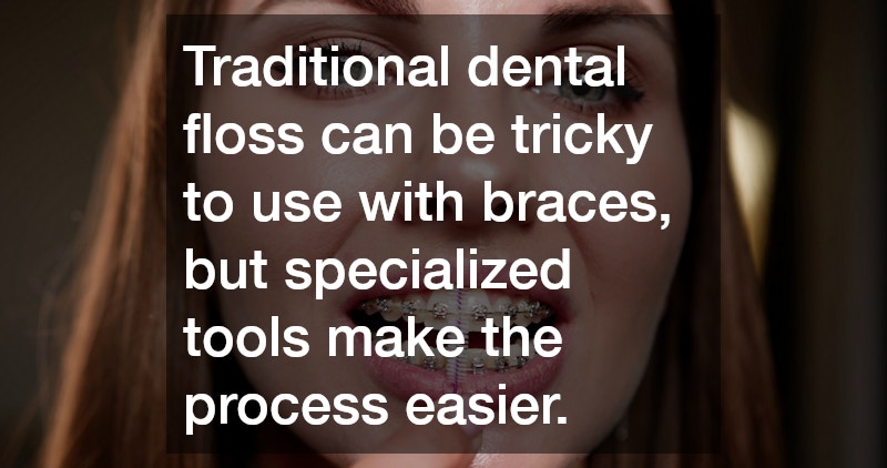 Traditional dental floss can be tricky to use with braces, but specialized tools make the process easier.