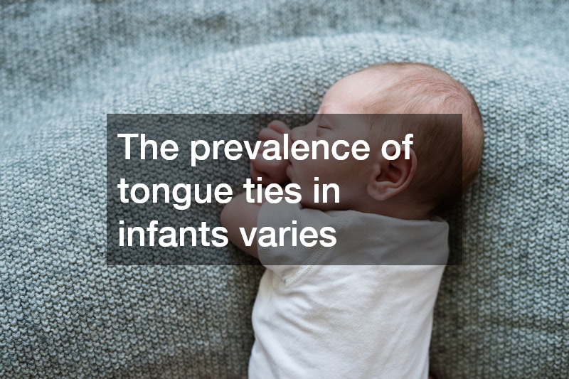 The prevalence of tongue ties in infants varies