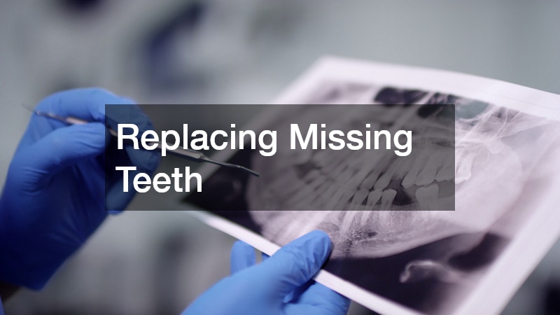 Replacing Missing Teeth