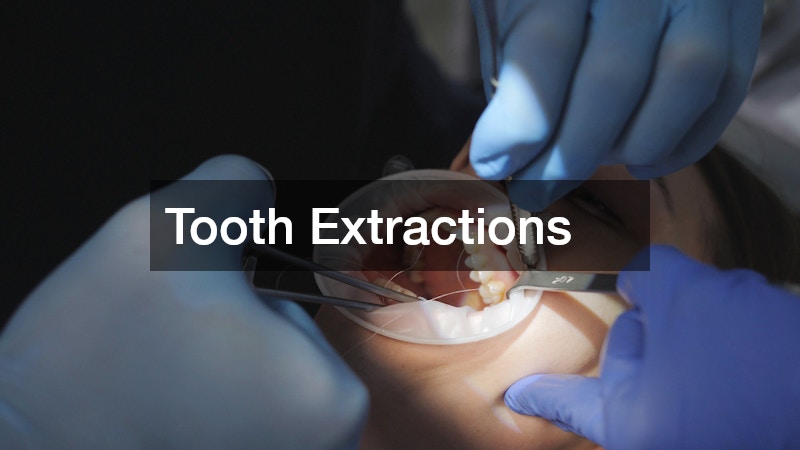 Tooth Extractions