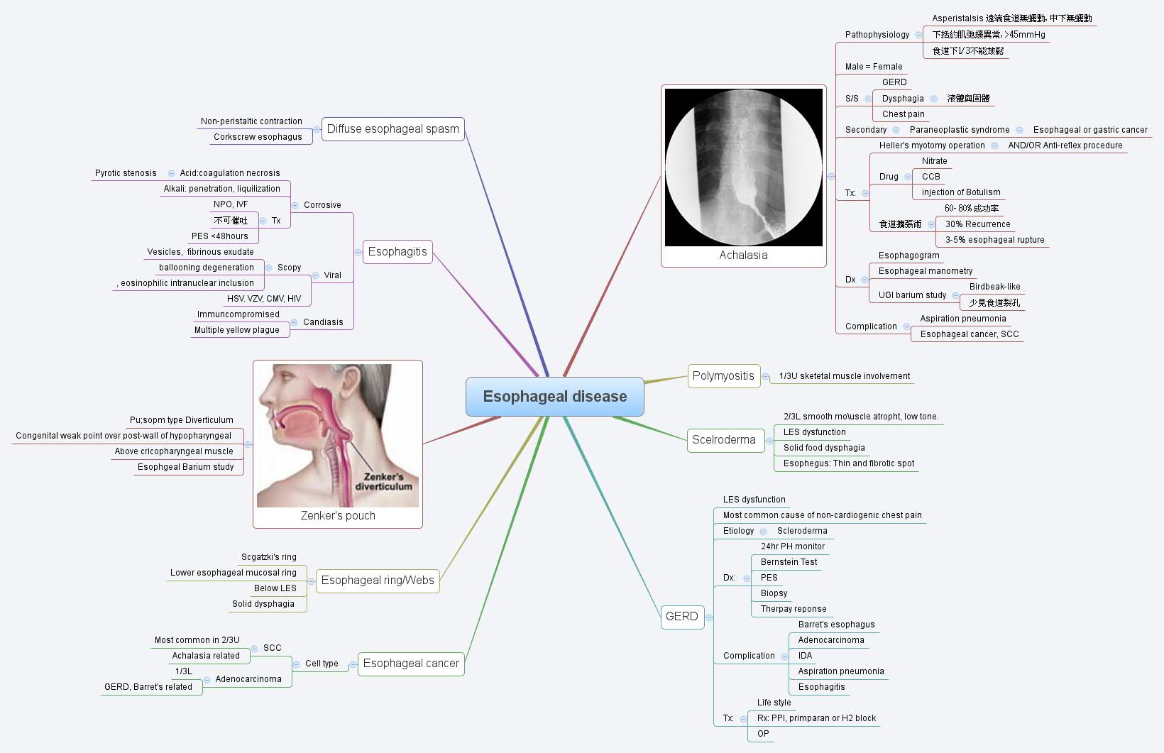 Esophageal disease - XMind - Mind Mapping Software