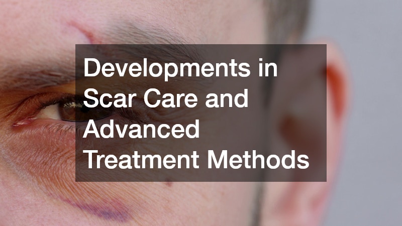 Developments in Scar Care and Advanced Treatment Methods