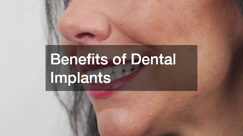 Benefits of Dental Implants